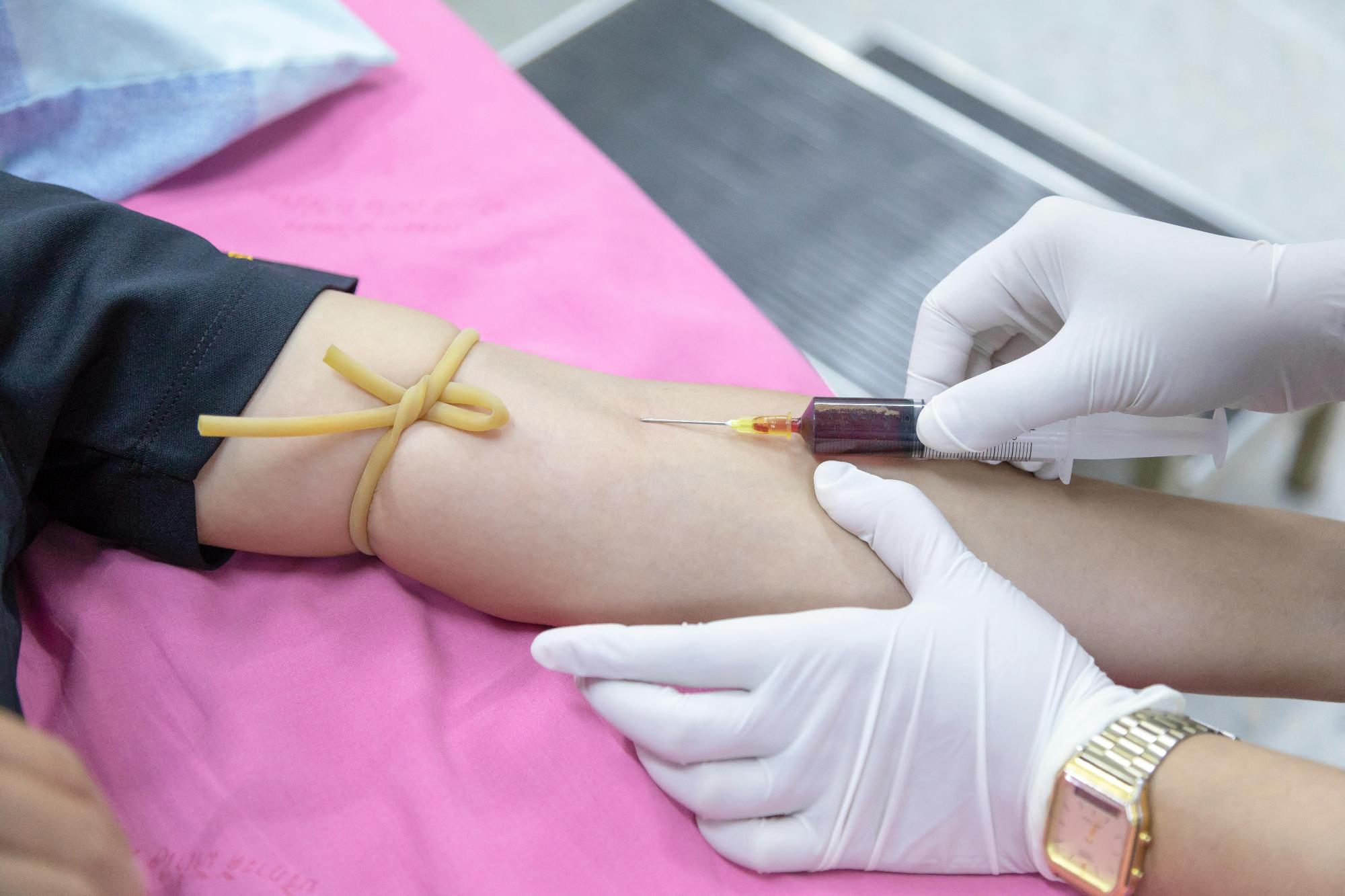 The Real Cost Of Managing Type 2 Diabetes Per Year